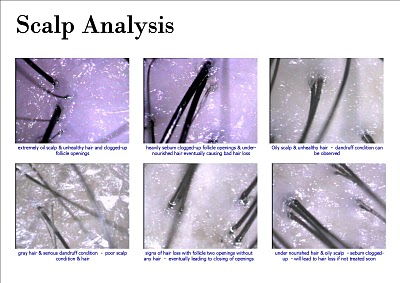 Scalp Analysis